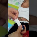 Cómo evitar que se le salga el ombligo a un bebé